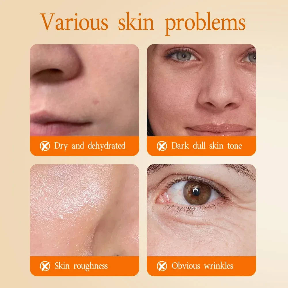 Snail Mucin Hydrating Skincare Set (5pcs) - Beautyturess