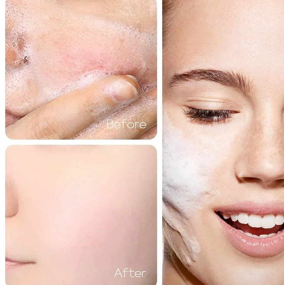 Aloe Vera Hydrating Facial Cleanser - Beautyturess