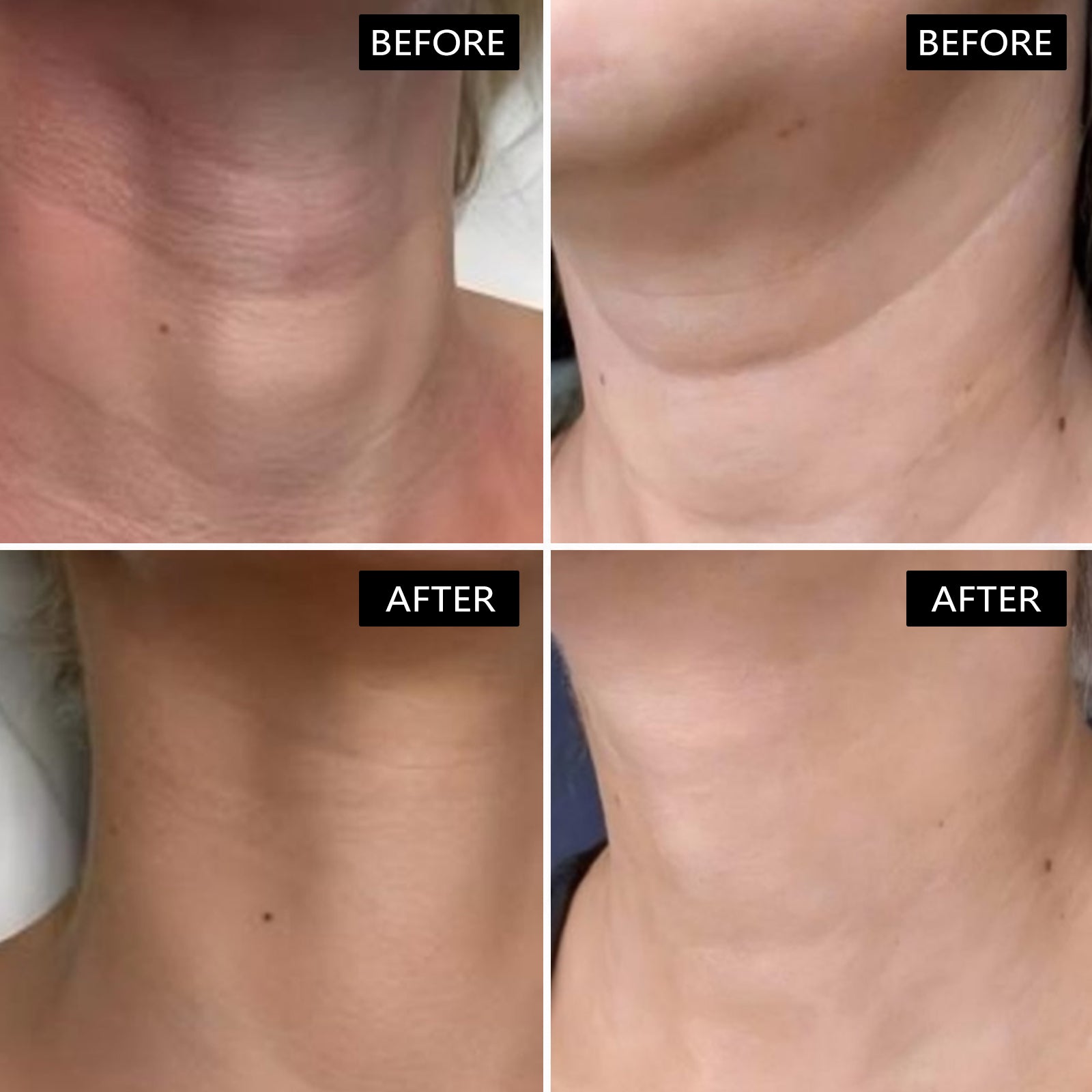 Neck & Décolleté Anti-Wrinkle Firming Cream