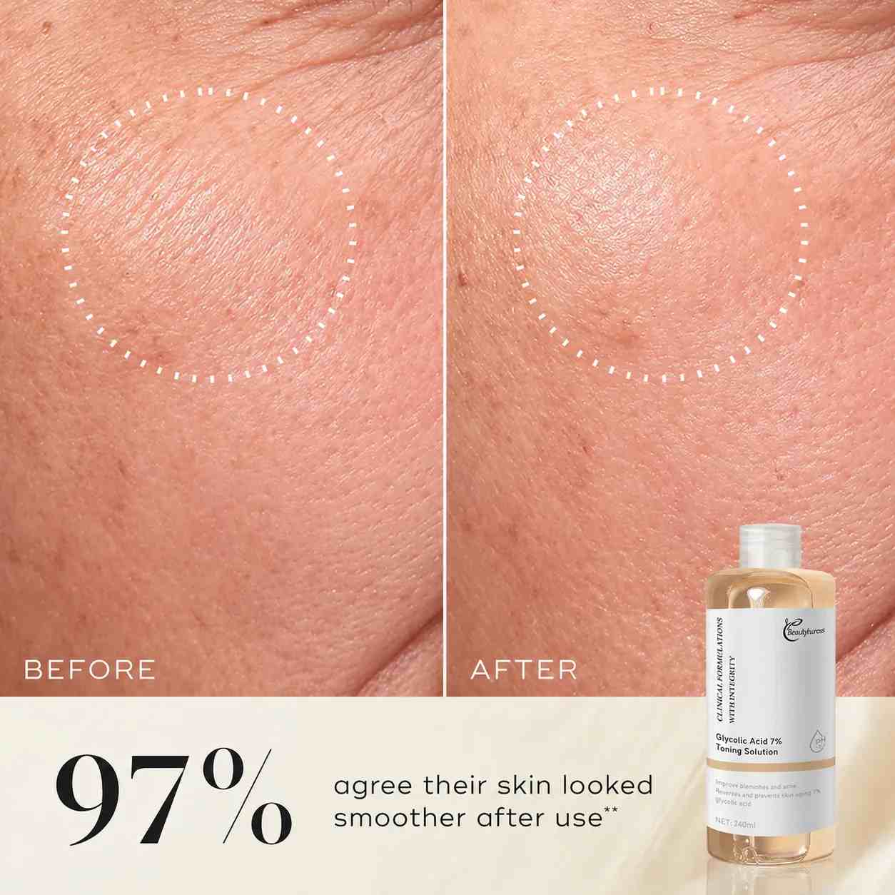 Exfoliating 7% AHA Toner (240ml) - Beautyturess