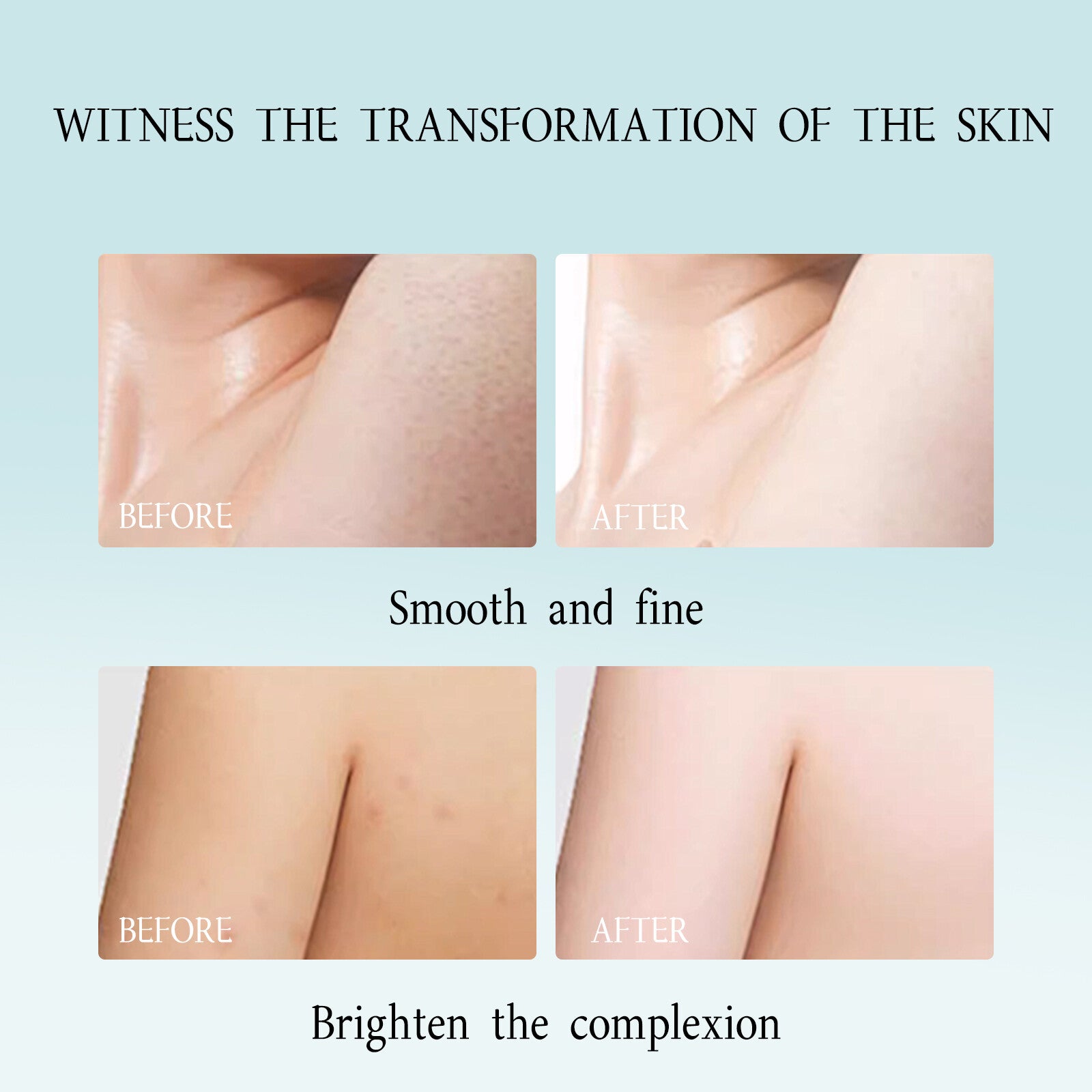 Gentle Skin Exfoliating Gel - Beautyturess