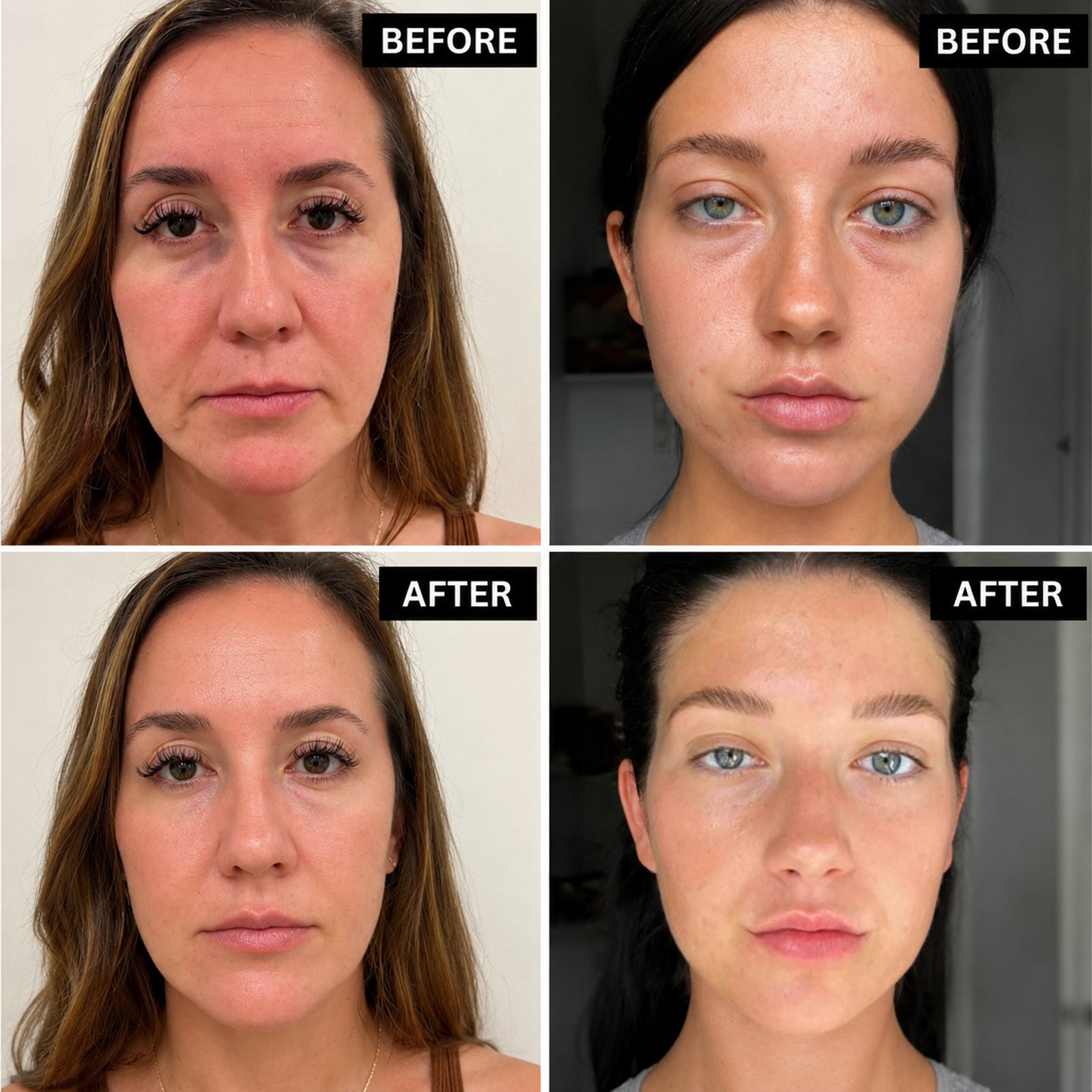 Bio-Peptide Firming & Wrinkle Correcting Skincare Set (6pcs)