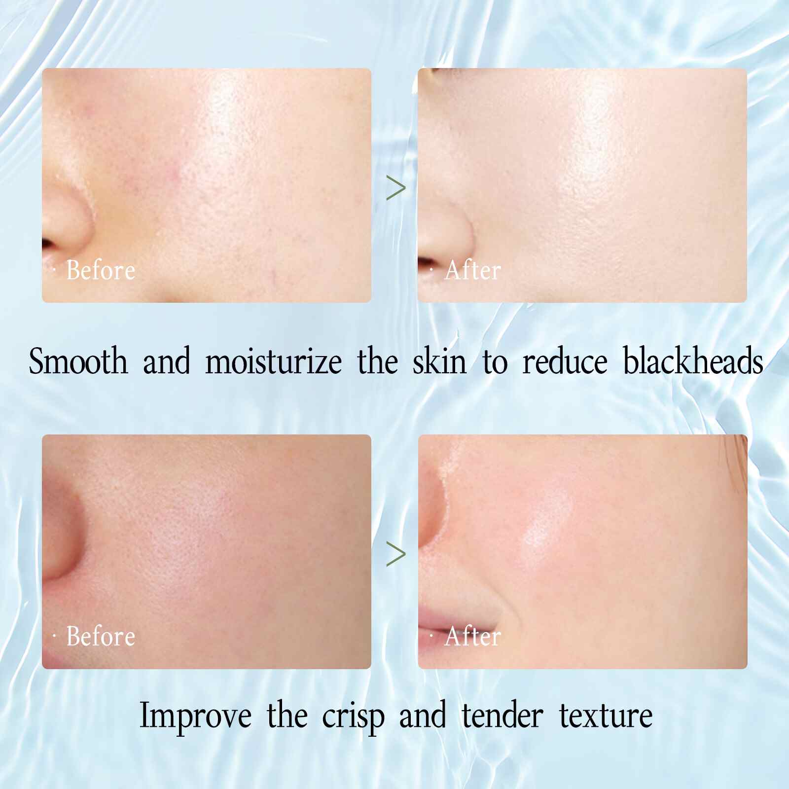 Niacinamide Facial Moisturizing Night Cream - Beautyturess