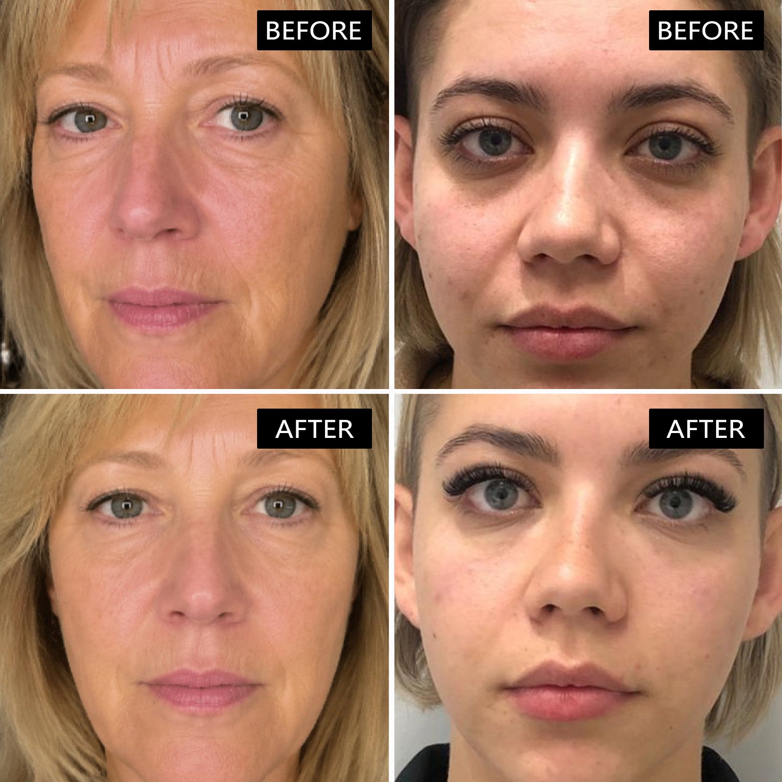 Collagen Anti-Aging Radiance Face Mask (24 Pack)