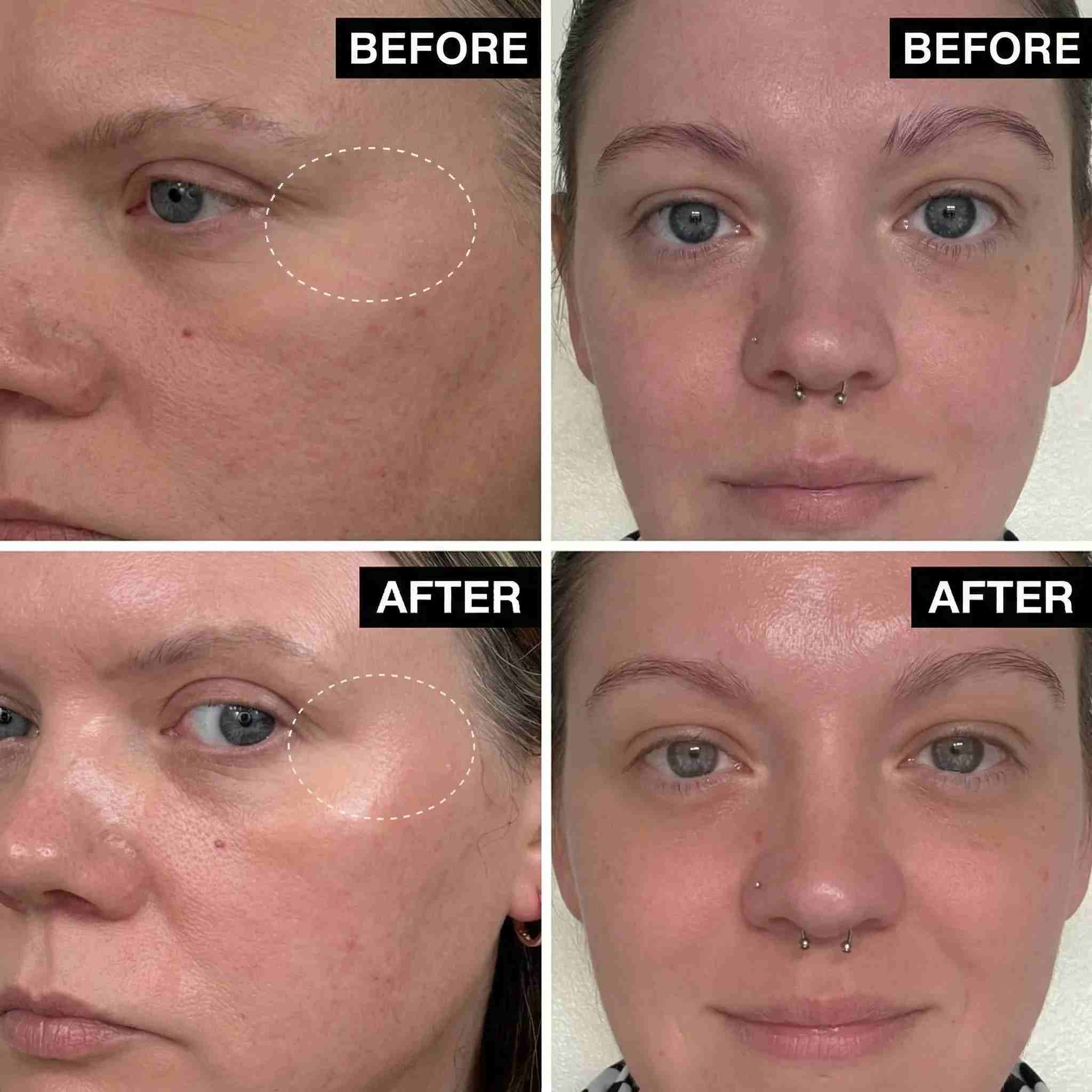 24K Gold Wrinkle Correcting Skincare Set (9pcs) - Beautyturess