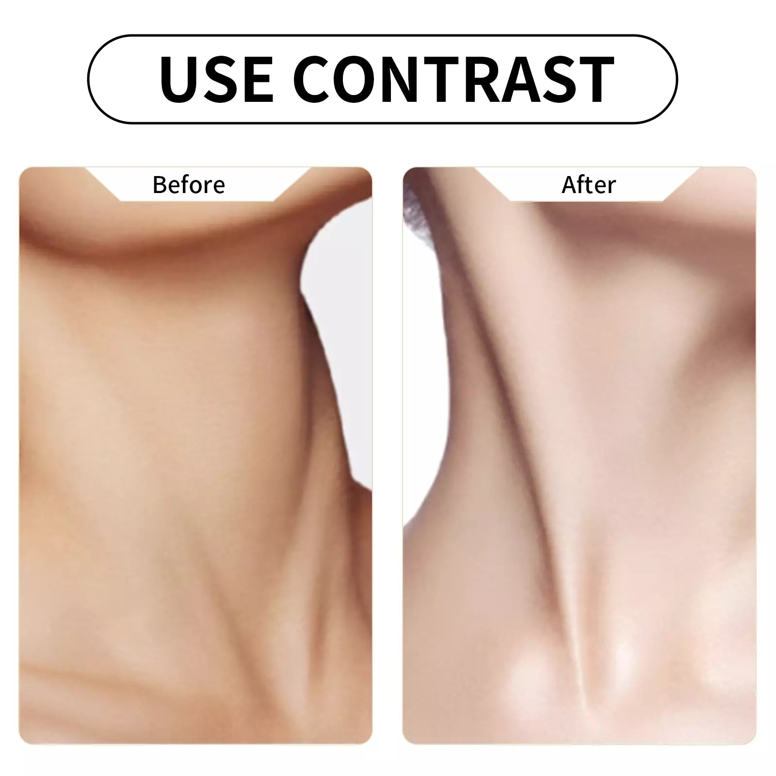 Astragalus Polypeptide Neck Mask (10Pack) - Beautyturess