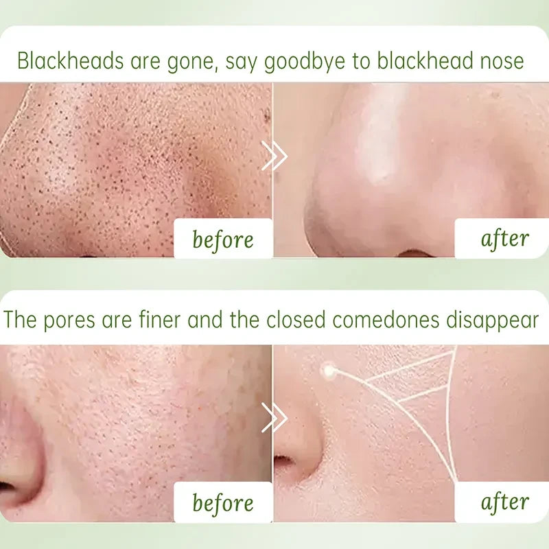 Multi-Acid Tea Clay Bubble Mask (16 Pack) - Beautyturess
