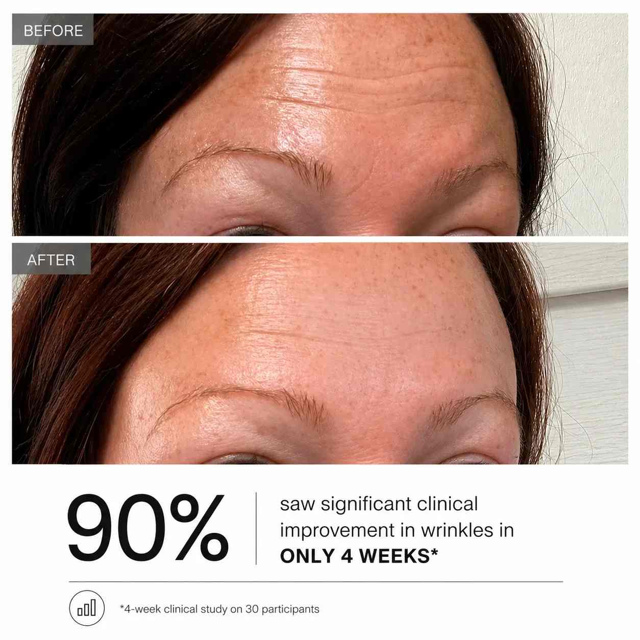 Retinol Collagen Wrinkle Smoothing Day Cream - Beautyturess