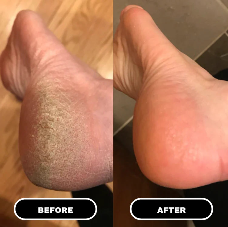 Goat Milk & Niacinamide Silky Foot Mask - Beautyturess