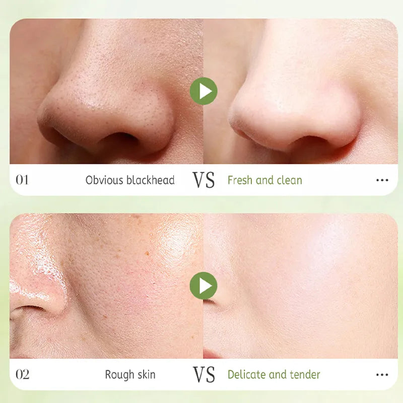 Composite Acid Tea Mud Bubble Mask (12 Pack) - Beautyturess